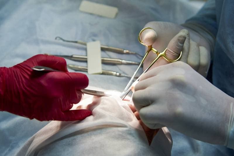 Hospital Regional faz cirurgia rara em criança e corrige malformação da língua